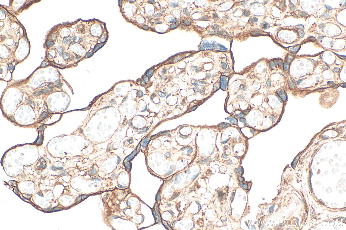 IHC staining of human placenta using 21169-1-AP