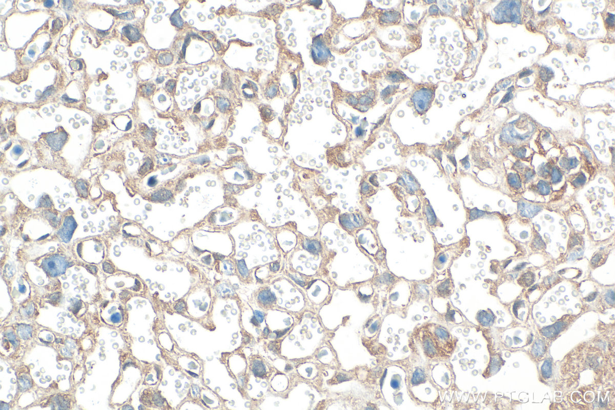 IHC staining of mouse placenta using 21169-1-AP