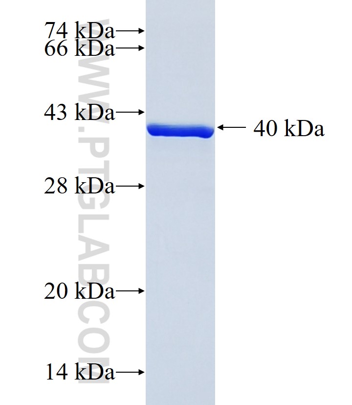 PITPNM2 fusion protein Ag15385 SDS-PAGE