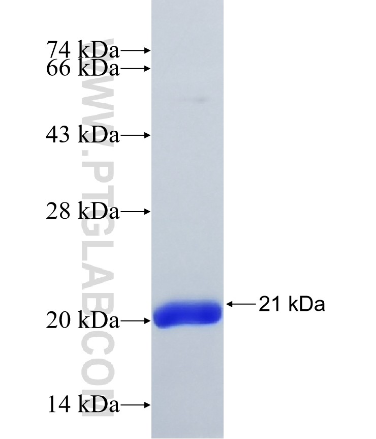 PITPNM2 fusion protein Ag16535 SDS-PAGE PITPNM2 fusion protein Ag16535 SDS-PAGE