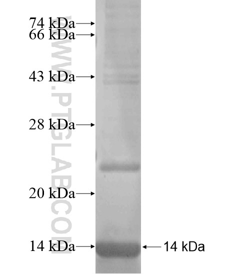 PITPNM3 fusion protein Ag19843 SDS-PAGE PITPNM3 fusion protein Ag19843 SDS-PAGE