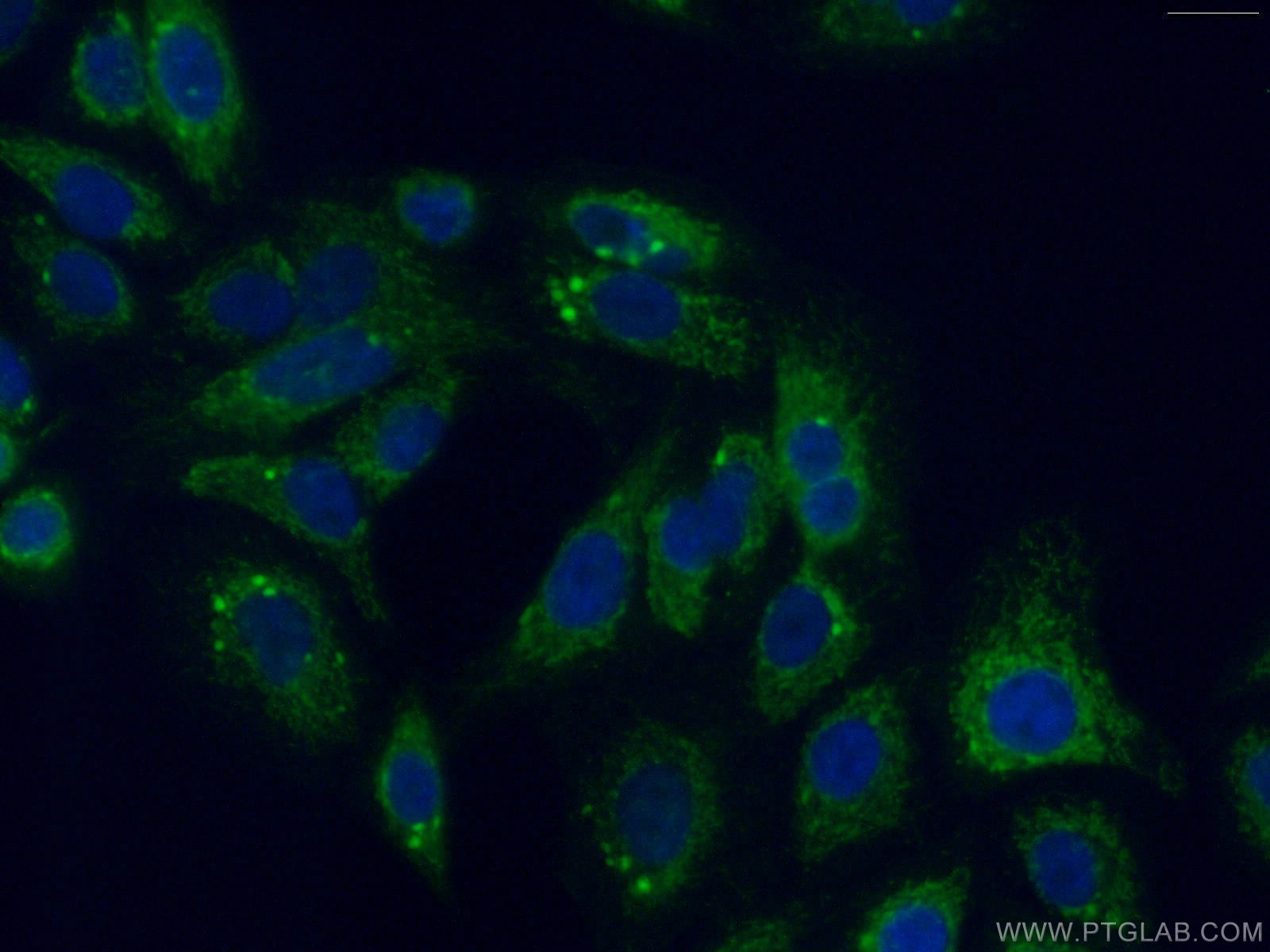 IF Staining of A549 using 10101-2-AP