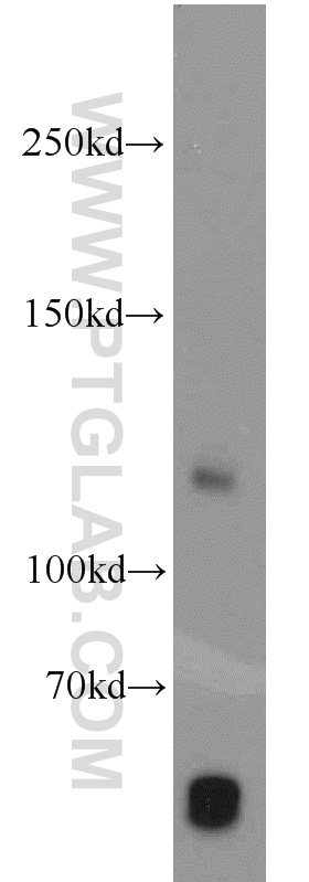 WB analysis of human placenta using 10101-2-AP