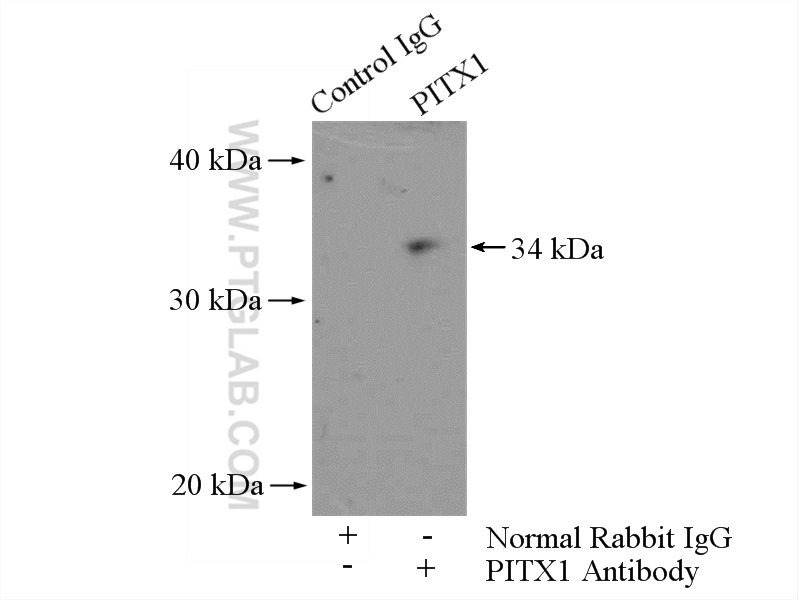 IP experiment of HeLa using 10873-1-AP