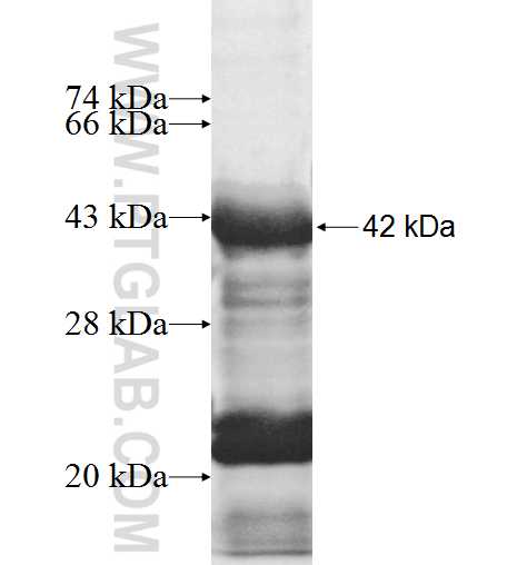 PITX3 fusion protein Ag10038 SDS-PAGE PITX3 fusion protein Ag10038 SDS-PAGE