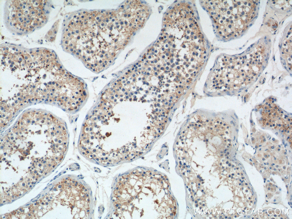 IHC staining of human testis using 14209-1-AP