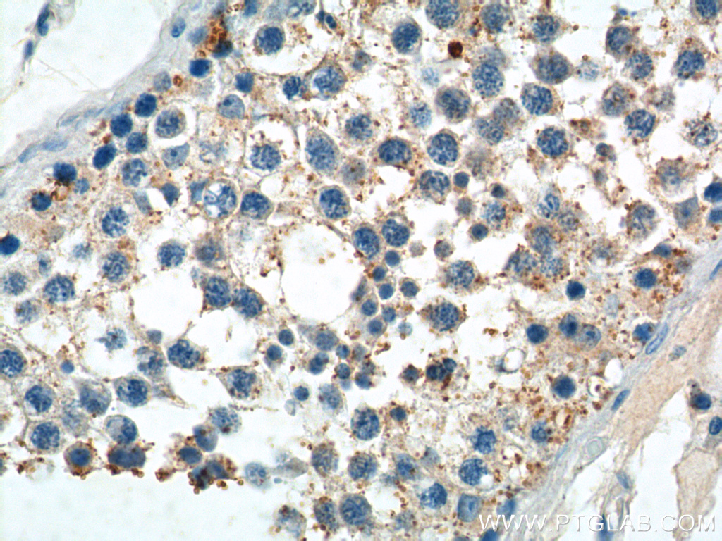 IHC staining of human testis using 14209-1-AP