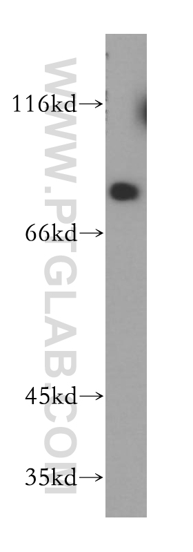 WB analysis of mouse brain using 17687-1-AP