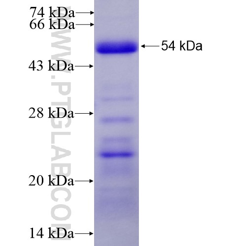 PJA1 fusion protein Ag11742 SDS-PAGE