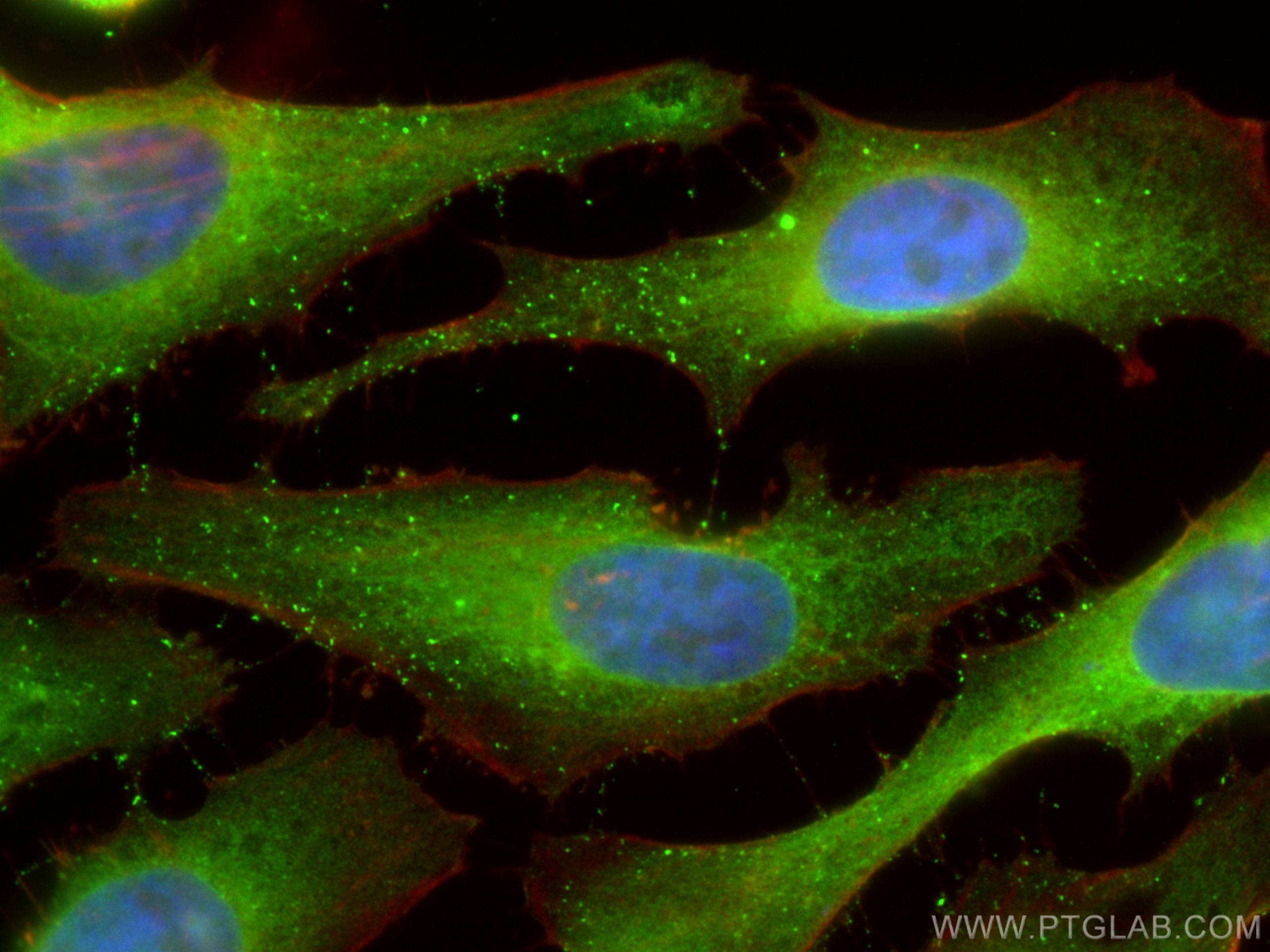 IF Staining of HeLa using 60268-1-Ig