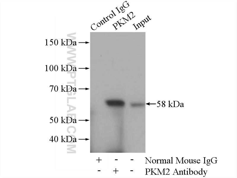 IP experiment of HeLa using 60268-1-Ig