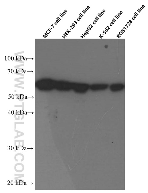 PKM2-specific Monoclonal antibody