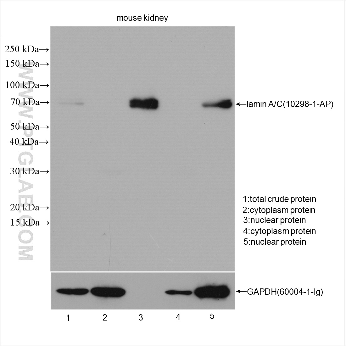 上样量：30 μg ；   抗体：Lamin  A/C<br>货号：10298-1-AP   稀释度：1 : 6000<br>曝光时间：10 s<br>Lane 1：总蛋白<br>Lane 2-3：使用 Proteintech 细胞核蛋白与胞浆蛋白抽提试剂盒提取的核蛋白与胞浆蛋白检测<br>Lane 4-5：使用其他公司产品提取的核蛋白与胞浆蛋白检测