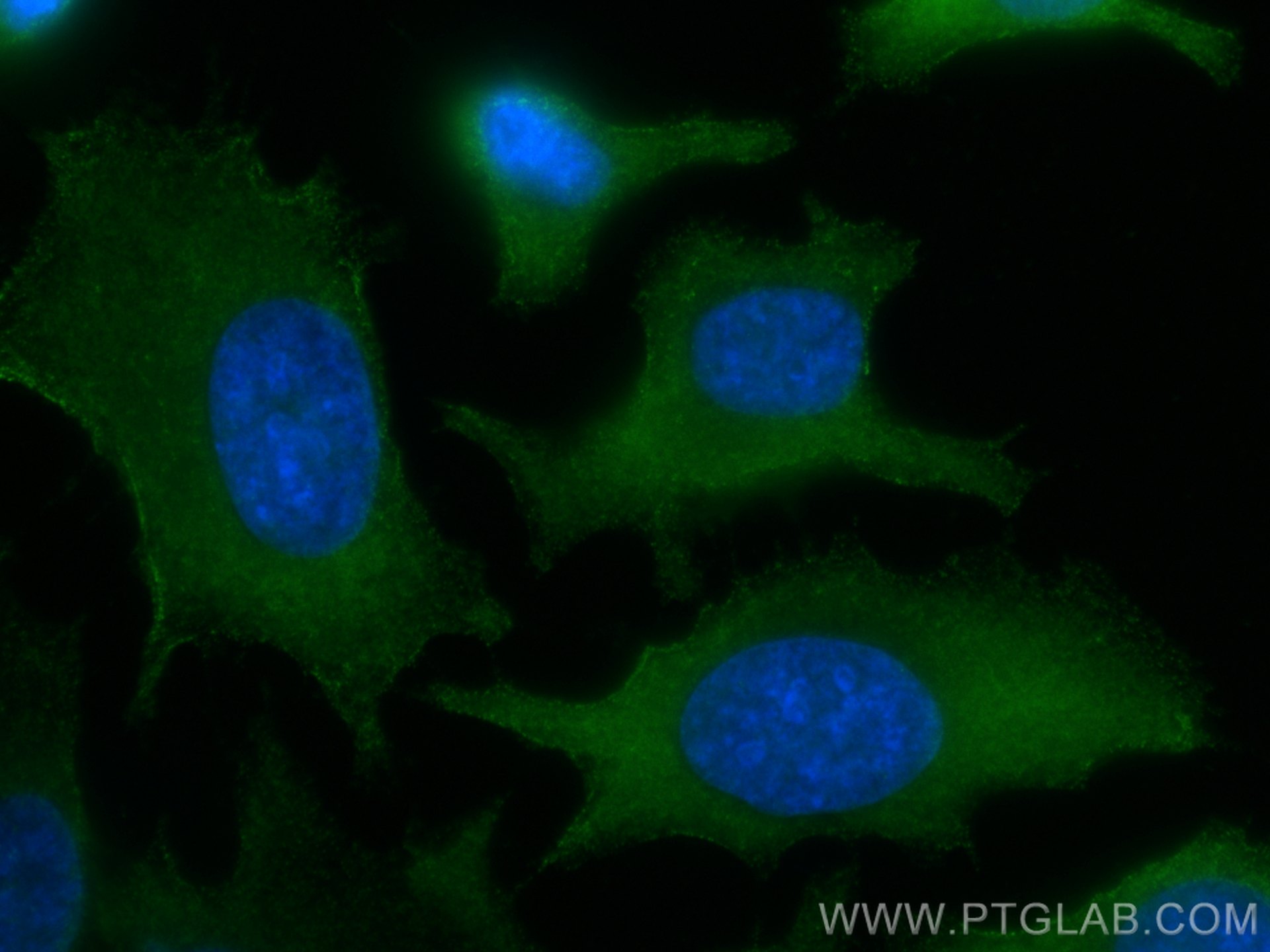 IF Staining of HeLa using 66421-1-Ig (same clone as 66421-1-PBS)