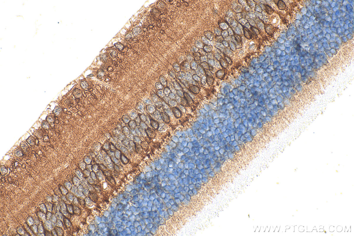 Immunohistochemical analysis of paraffin-embedded mouse eye tissue slide using 66421-1-Ig (PKC Alpha antibody) at dilution of 1:200 (under 40x lens). Heat mediated antigen retrieval with Tris-EDTA buffer (pH 9.0). IHC staining of mouse eye using 66421-1-Ig