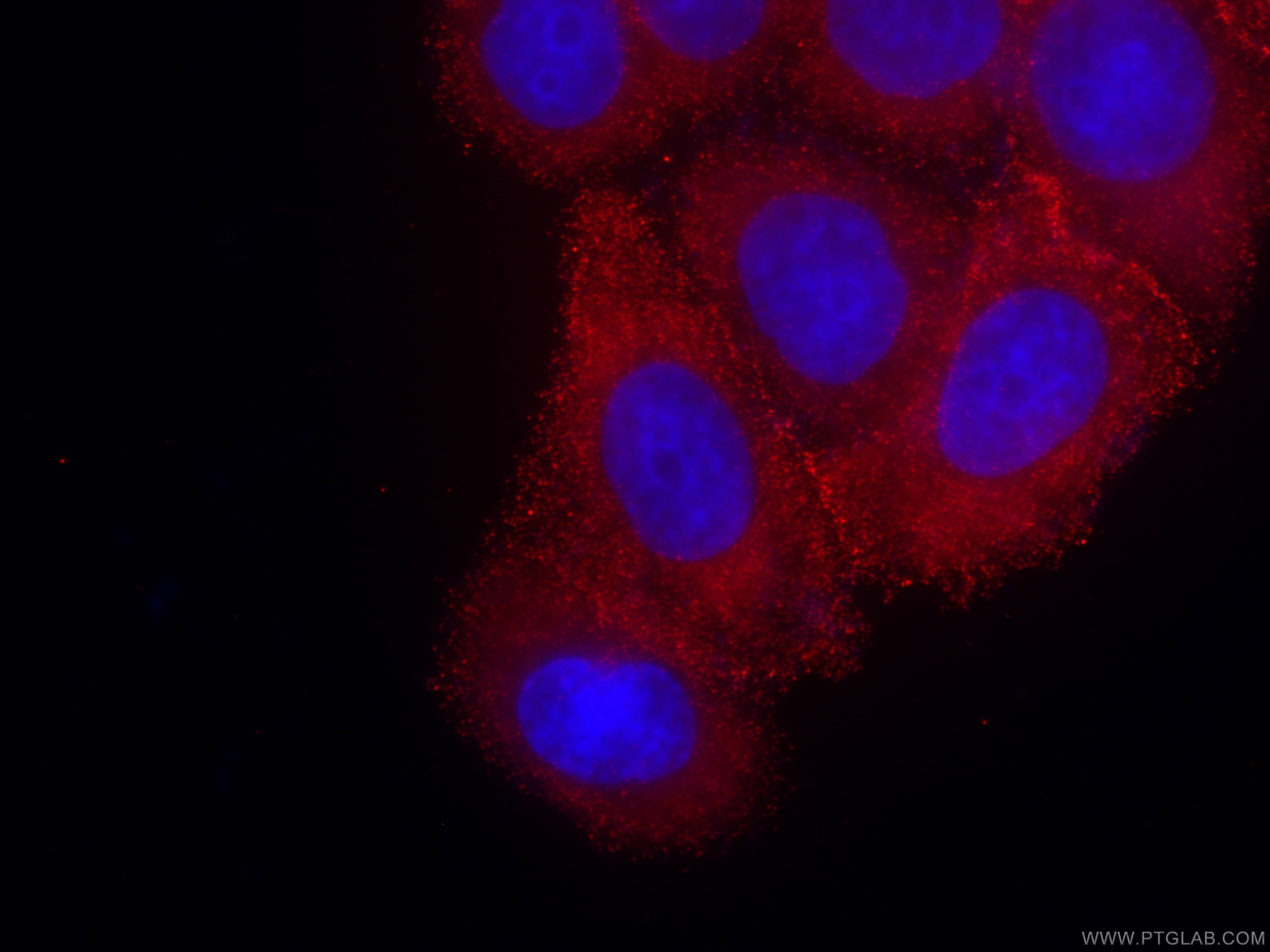 IF Staining of HeLa using CL594-66421