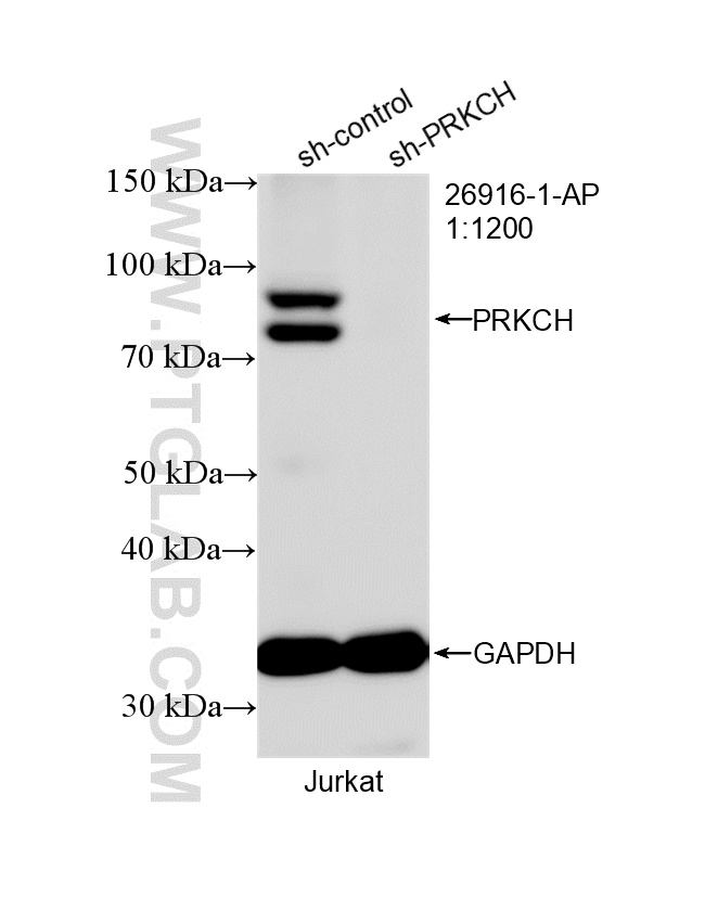 WB analysis of Jurkat using 26916-1-AP