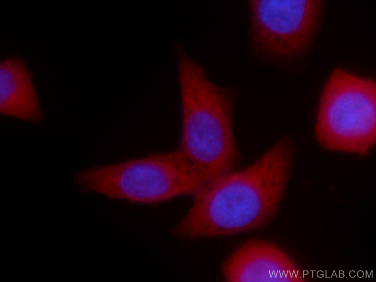 IF Staining of HeLa using CL594-66493