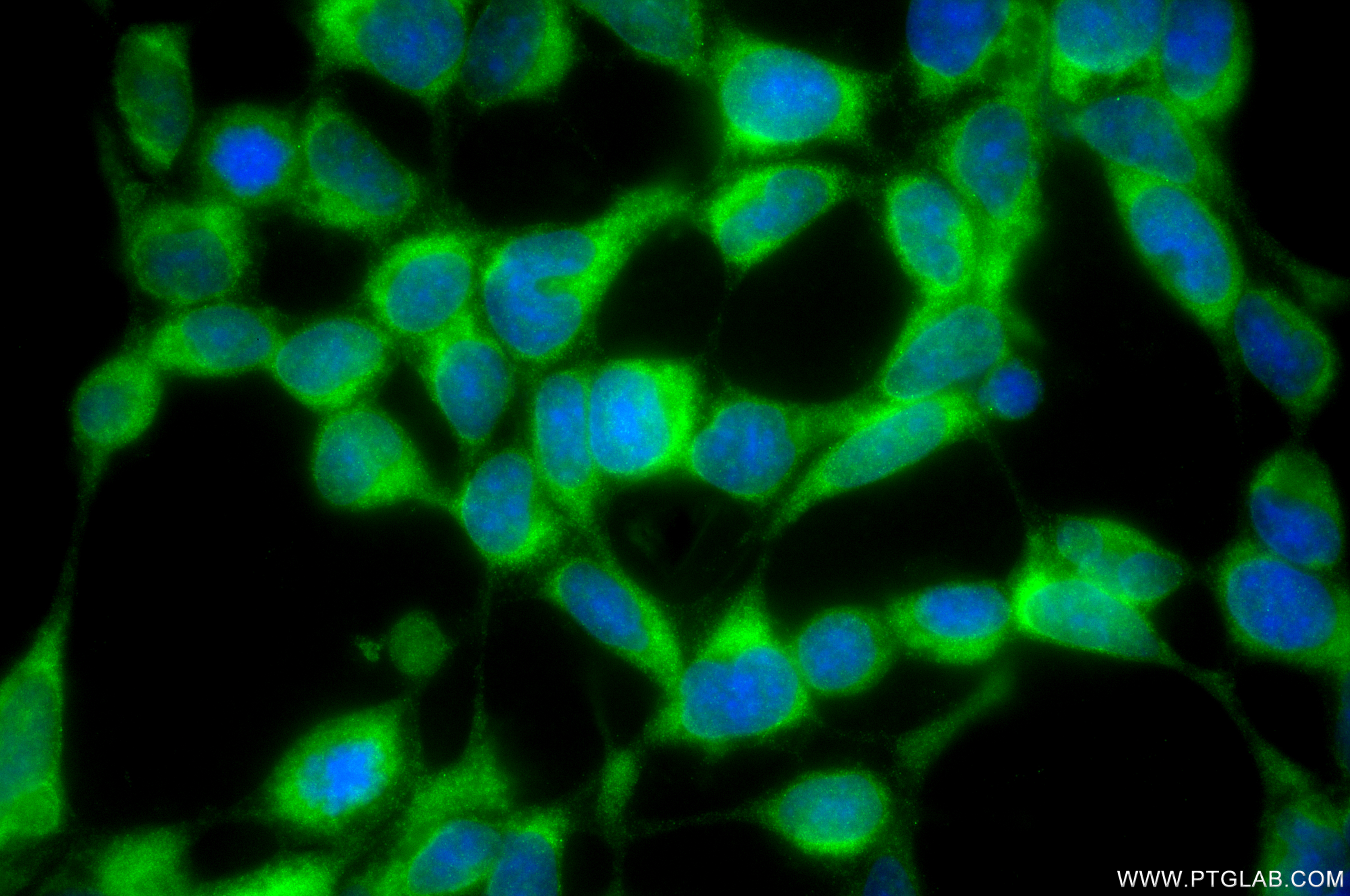 Immunofluorescent analysis of (-20°C Methanol) fixed HEK-293 cells using PKD2 antibody (82524-2-RR, Clone: 251151C3 ) at dilution of 1:400 and CoraLite®488-Conjugated Goat Anti-Rabbit IgG(H+L) (<a class='green' href='/productredirect?CatalogNo=SA00013-2' target='_blank'>SA00013-2</a>). IF Staining of HEK-293 using 82524-2-RR