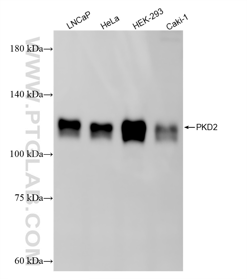 Various lysates were subjected to SDS PAGE followed by western blot with 82524-2-RR (PKD2 antibody) at dilution of 1:2000 incubated at room temperature for 1.5 hours. WB analysis using 82524-2-RR