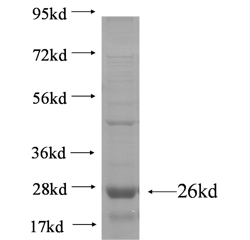 PKD2L2 fusion protein Ag5011 SDS-PAGE