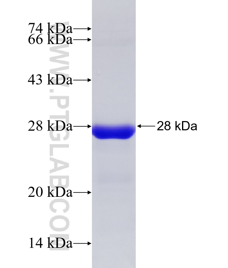 PKHD1 fusion protein Ag30443 SDS-PAGE