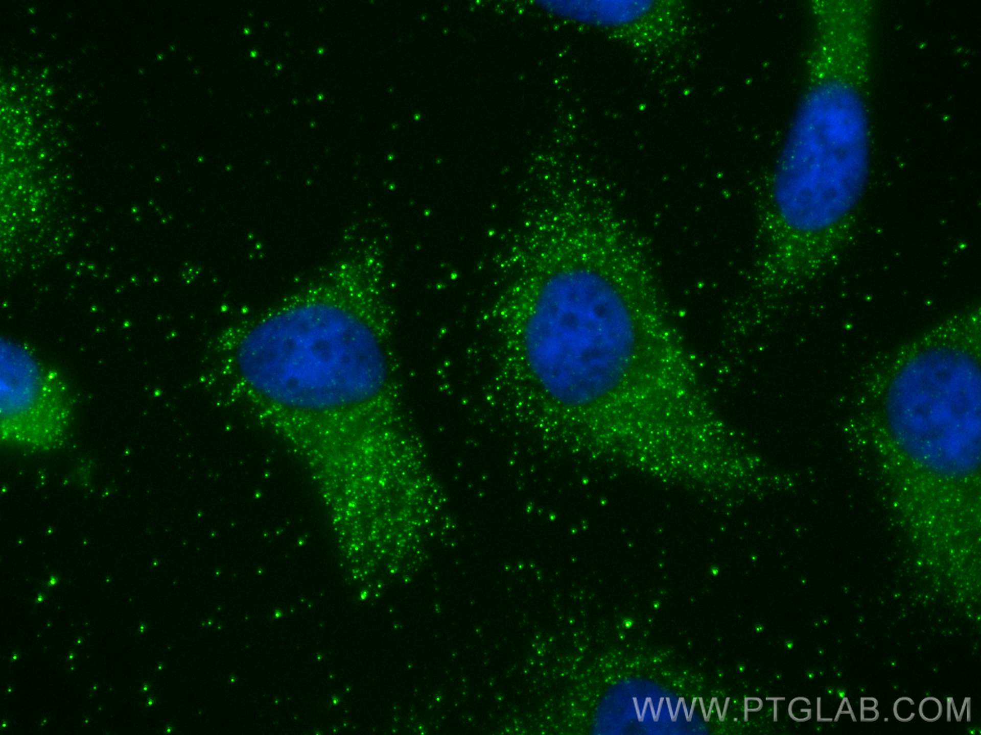 IF Staining of HeLa using 11743-1-AP