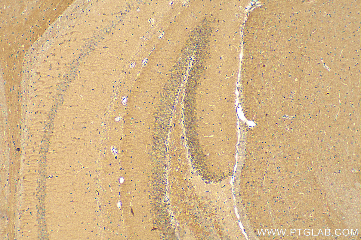 IHC staining of mouse brain using 11743-1-AP