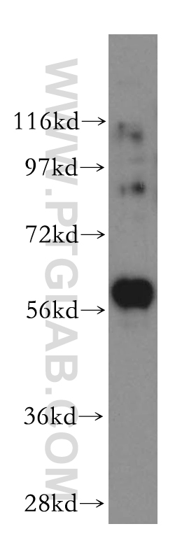 WB analysis of K-562 using 17580-1-AP