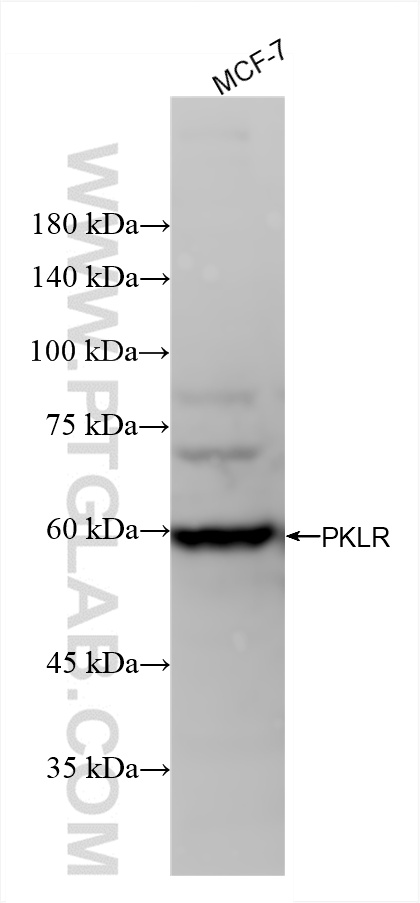 WB analysis of MCF-7 using 86485-1-RR