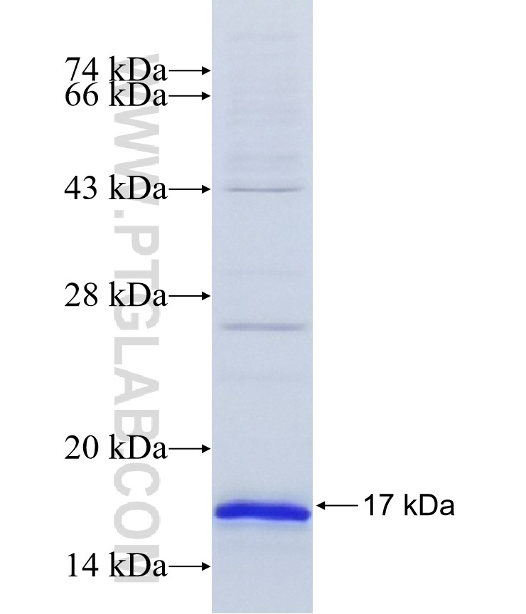 PKLR fusion protein Ag17884 SDS-PAGE PKLR fusion protein Ag17884 SDS-PAGE