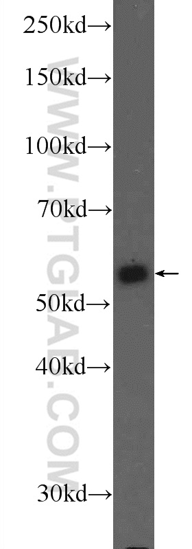 PKM Polyclonal antibody