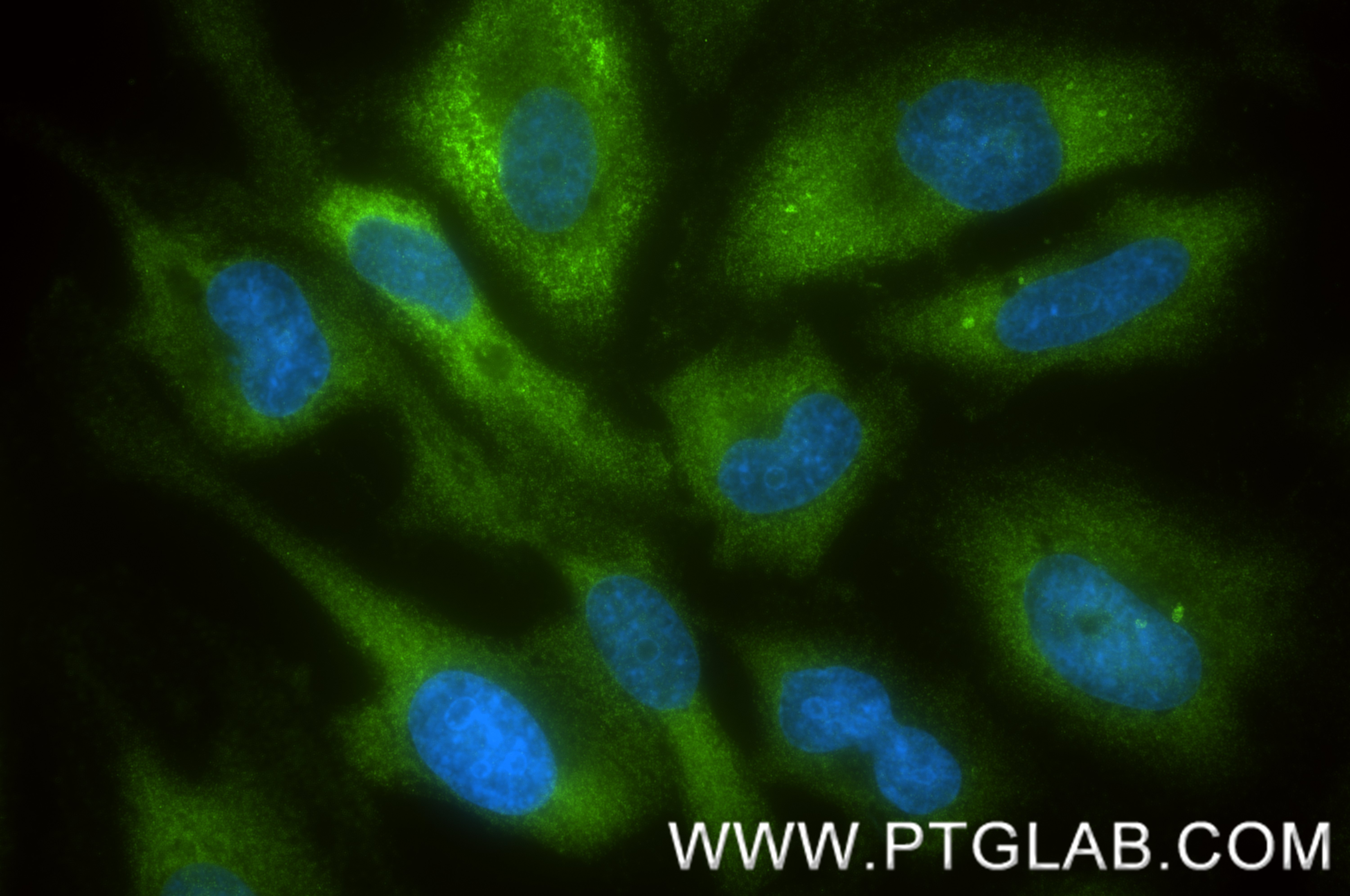IF Staining of HeLa using 84451-3-RR IF Staining of HeLa using 84451-3-RR