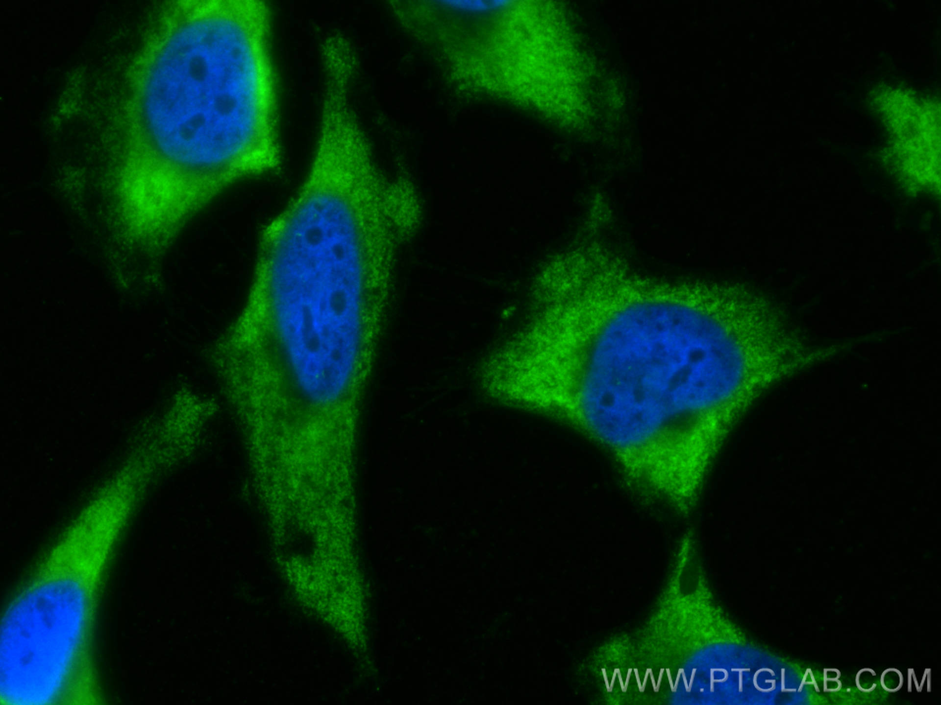 IF Staining of HeLa using CL488-10078