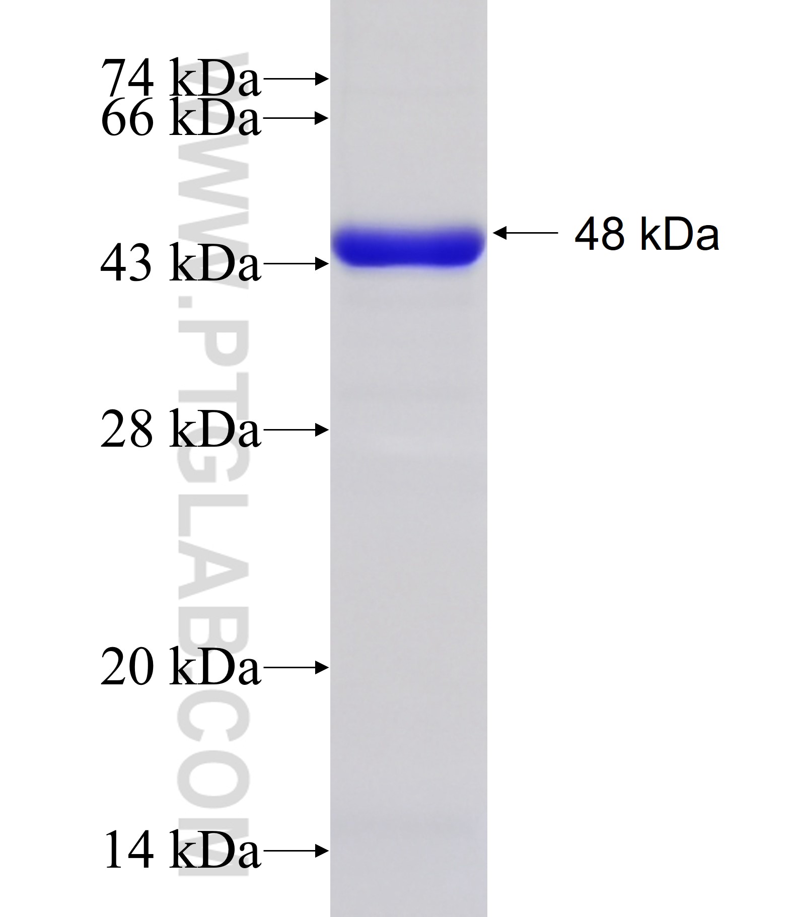 PKM1 fusion protein Ag24549 SDS-PAGE