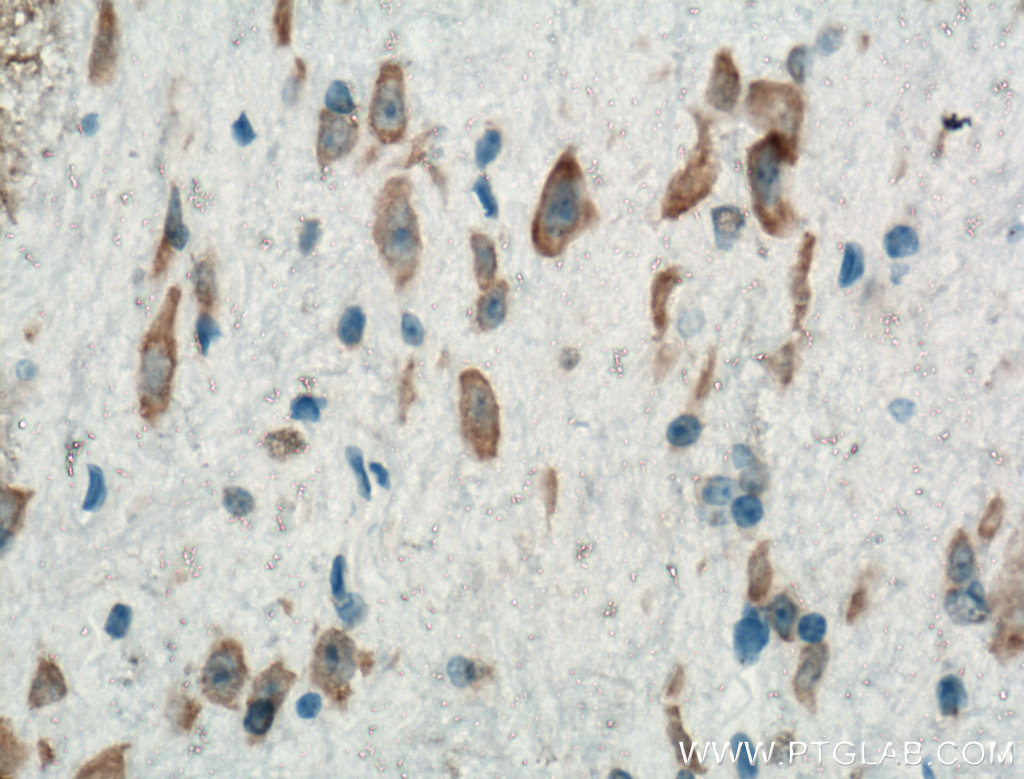 IHC staining of mouse brain using Biotin-15821