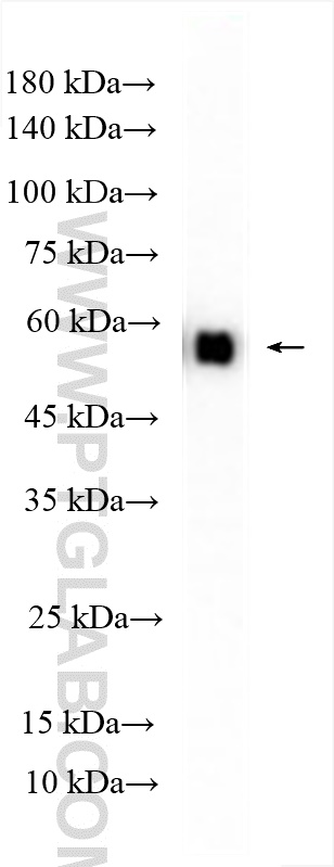 WB analysis of rat skeletal muscle using 10078-2-AP