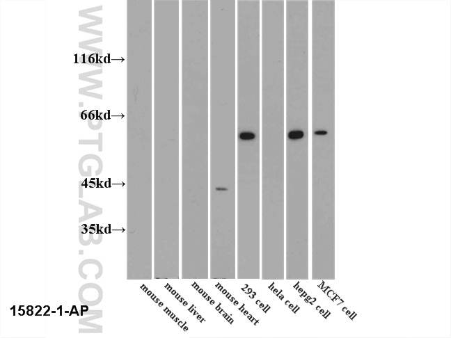 PKM2-specific Polyclonal antibody