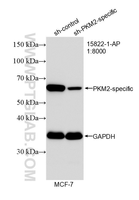 WB analysis of MCF-7 using 15822-1-AP WB analysis of MCF-7 using 15822-1-AP