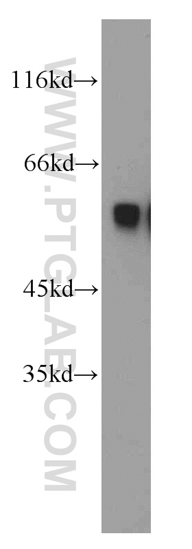 WB analysis of mouse brain using 55098-1-AP