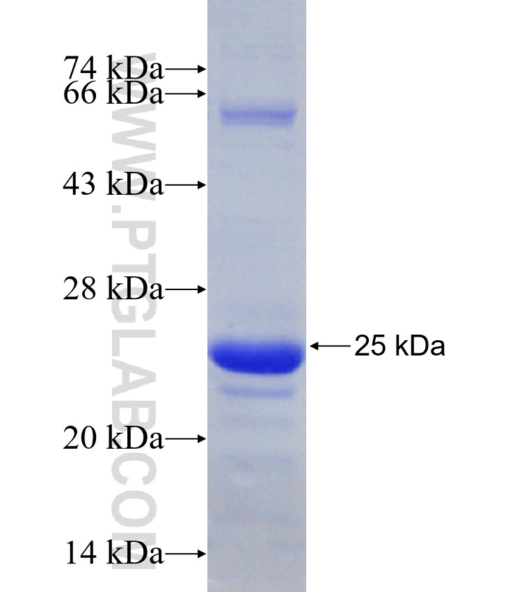 PKMYT1 fusion protein Ag30849 SDS-PAGE