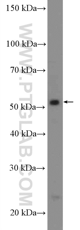 WB analysis of SH-SY5Y using 10614-1-AP