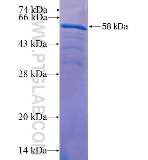 PKNOX1 fusion protein Ag0939 SDS-PAGE