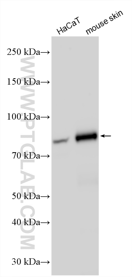 WB analysis using 22632-1-AP (same clone as 22632-1-PBS) WB analysis using 22632-1-AP (same clone as 22632-1-PBS)
