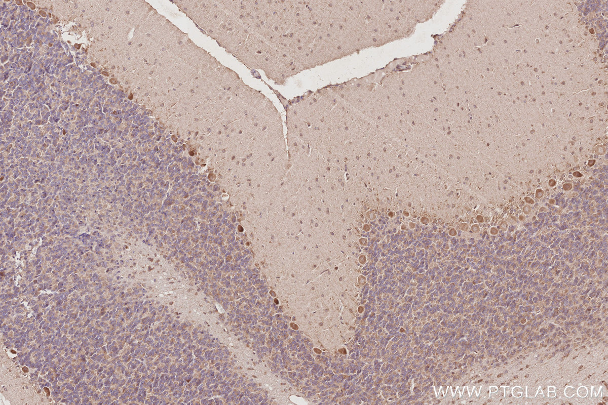 IHC staining of rat cerebellum using 18338-1-AP IHC staining of rat cerebellum using 18338-1-AP