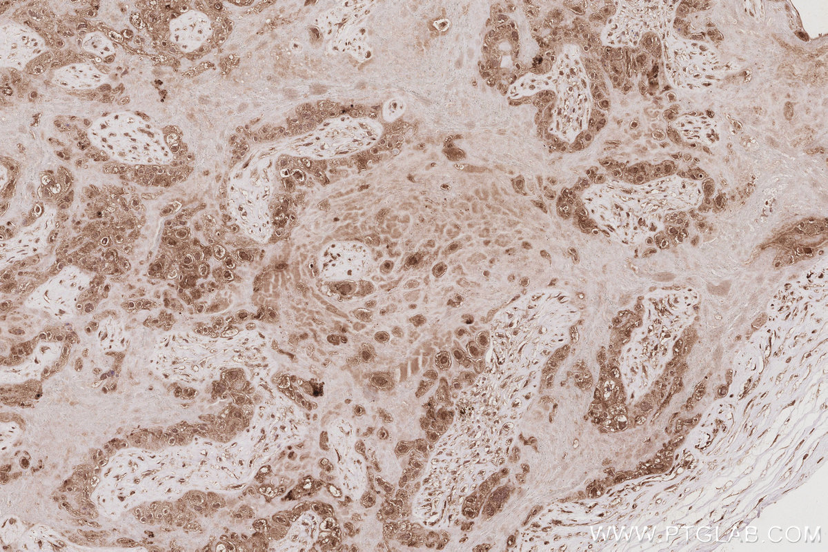 IHC staining of human placenta using 18338-1-AP IHC staining of human placenta using 18338-1-AP