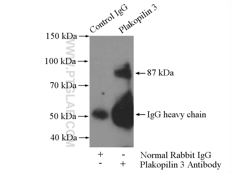 IP experiment of A549 using 18338-1-AP