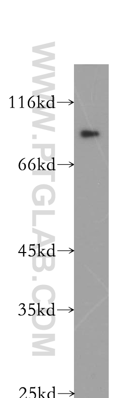 Plakophilin 3 Polyclonal antibody