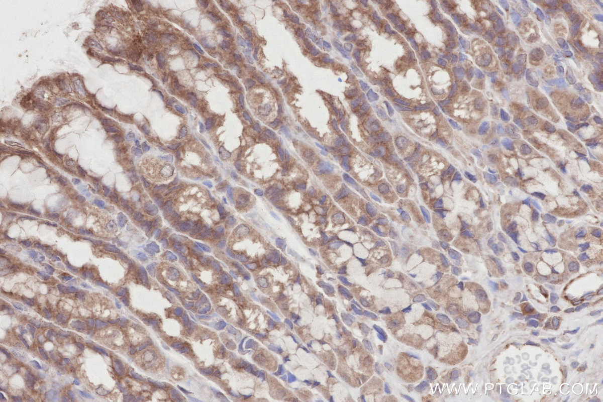IHC staining of rat stomach using 14062-1-AP IHC staining of rat stomach using 14062-1-AP
