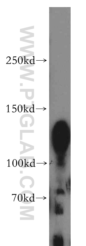 WB analysis of A431 using 14062-1-AP